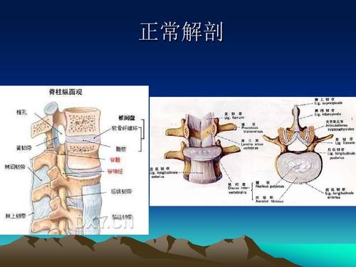 脊柱和椎管内病变mri诊断