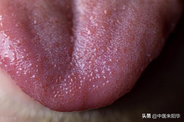 正常的舌苔是不厚也不薄的,不干也不湿的,属于润润的状态,舌面比较
