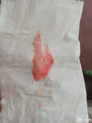 这是着床出血吗?