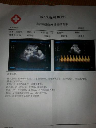 复了六次b超,还是女孩,不想说什么了,要女宝的来接走吧