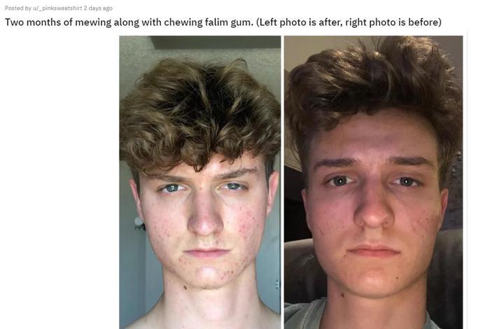 只需矫正呼吸和咀嚼方法就能改变下颌线和脸型这种不用花钱的美容方法