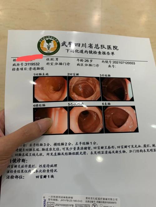 检查完了 没大问题 普通肠镜的感受_北京欢乐谷_欢乐谷_显示屏_抖音
