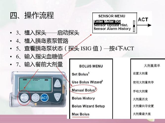 722动态血糖胰岛素泵操作步骤及注意事项ppt