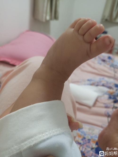 三个多月的x宝宝脚这样正常吗?