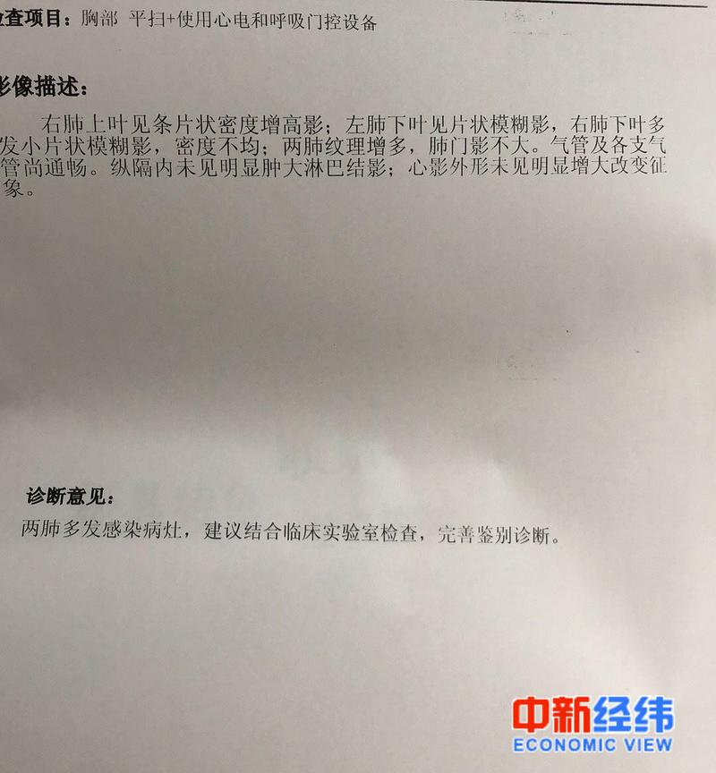 新冠肺炎康复者的24天:没有咳嗽发烧,我以为是小感冒