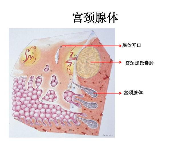 宫颈腺体 腺体开口 宫颈那氏囊肿 宫颈腺体