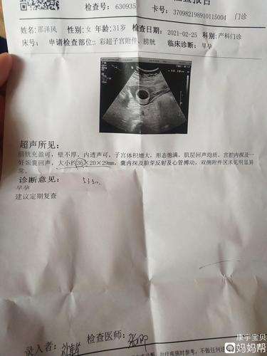 刚做的b超,大家看看是不是女孩[求女宝]