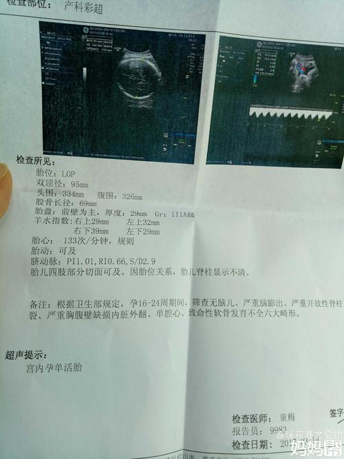 35周宝宝头大