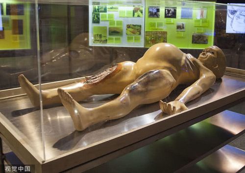 各种人体和人体器官的博物馆也是吸引了很多自然迷. (来自:图说)