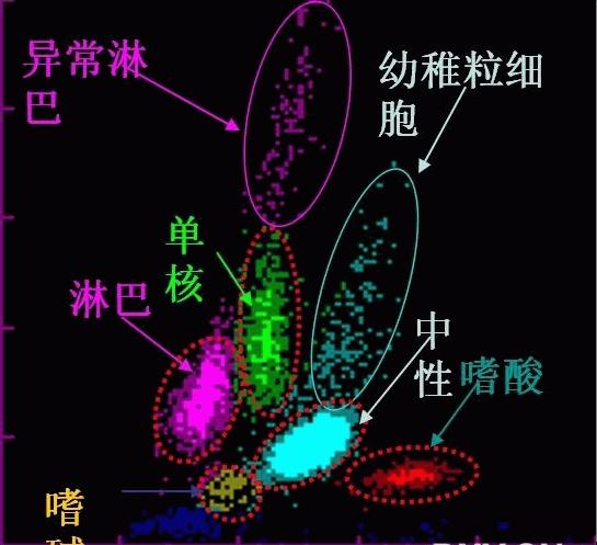 如何分析希森美康xt1800i血球仪的白细胞散点图