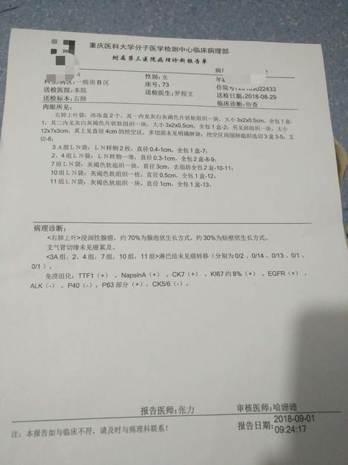 非小细胞肺癌  我妈妈肺腺癌,请大家帮忙看看这个病理结果怎么样 9887