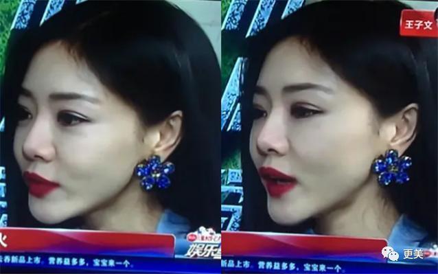 邓家佳怎么把自己整成李小璐,比娄艺潇还僵