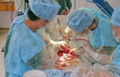 女人现场剖腹产全过程