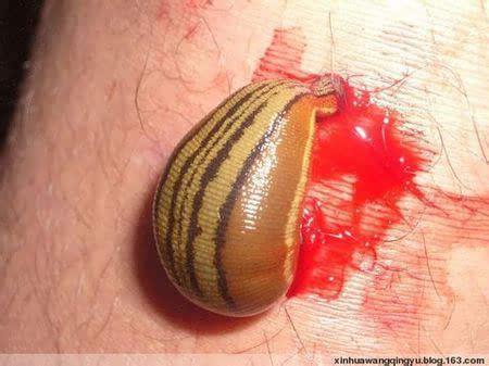 遍地吸人血的大蚂蝗