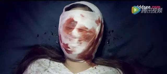 现实是:满脸绷带和血渍