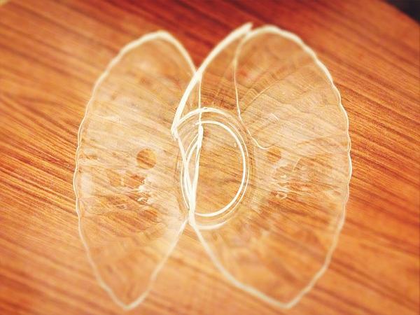 把家里最好看的一个玻璃碗打碎了,拼成个碎蝴蝶,流了一指头血.