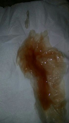 我老公的精液化验结果正常,可有时候同房后精液的颜色偏