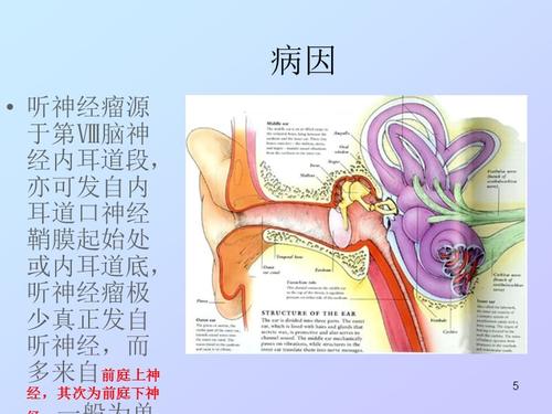听神经瘤诊断ppt课件.ppt