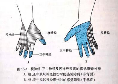 脑梗死|血管|神经损伤_网易订阅