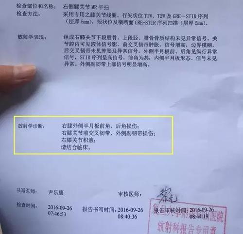 一个周未我身边就伤掉两位球友,一个半月板撕裂,一个小腿肌肉拉伤