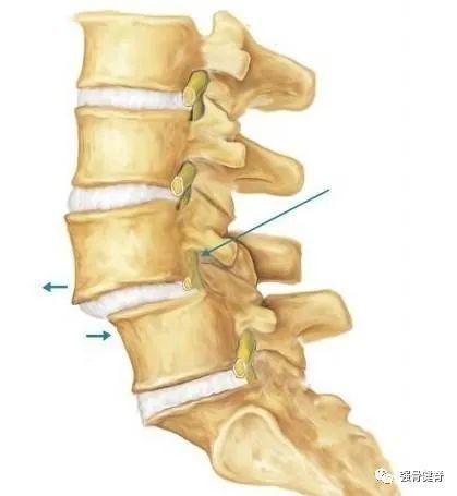 因为可以重建正常的腰椎及神经根的解剖位置