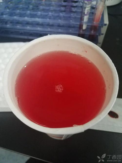 肉眼血尿,是出了多少血?