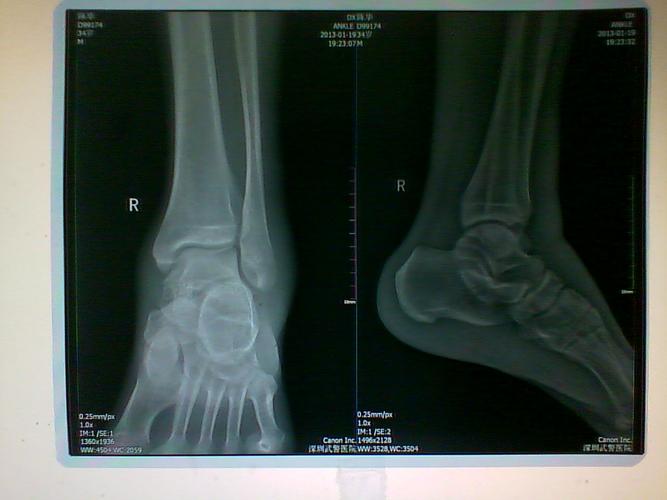 能否帮我看看x片啊