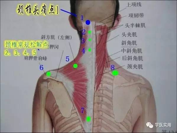 颈型颈椎病:最早期的颈椎病,预防护理得当可自愈!