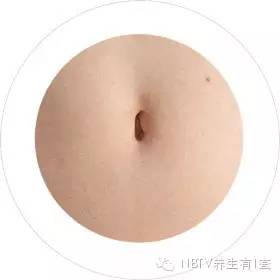 肚脐里的"泥"可以抠掉吗?没想到错了这么多年!