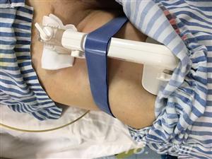 "普亚喜"动脉压迫止血器