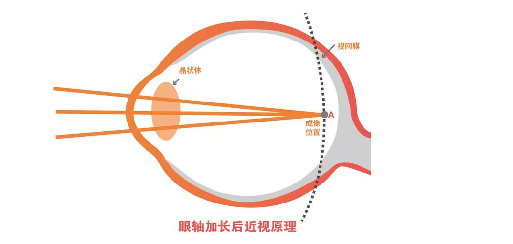 近视原理图