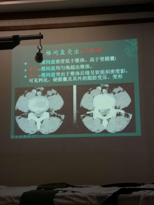 脊柱的核磁诊断