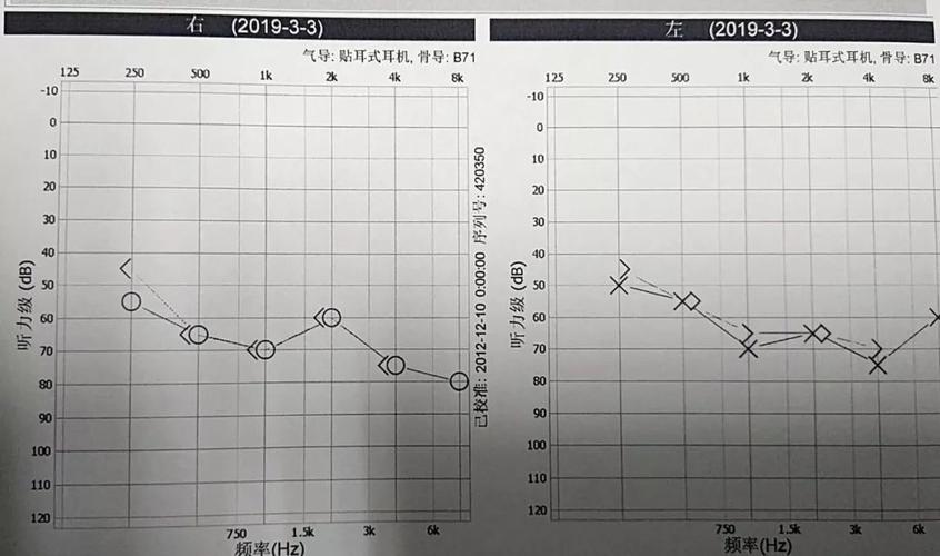 20 岁的年龄 70 岁的听力,「未老先聋」的年轻人越来越多