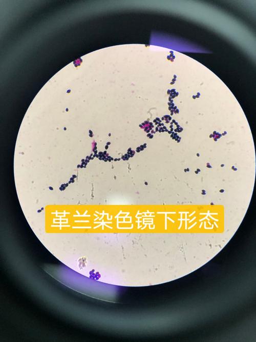 检出一例新型隐球菌----国健医学检验所