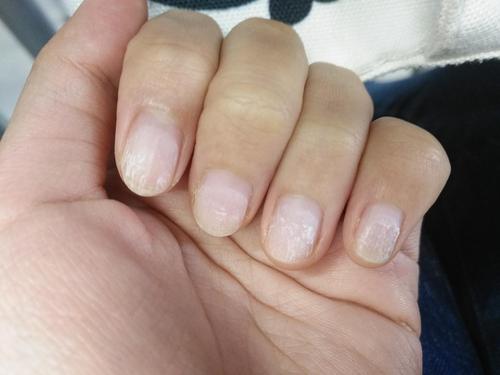 把美甲撕了之后指甲怎么护理啊01