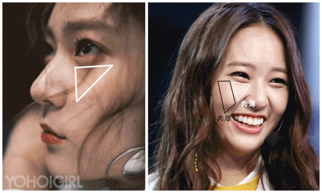 章子怡的眼下三角区也有轻微凹陷的,但因为她的颧骨相对也比较平,所以