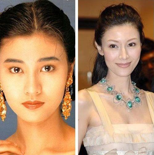 李嘉欣的鼻子是香港做的,为她做手术的是香港最出名