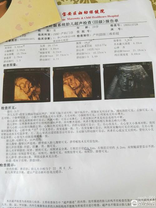 三维查出胎宝宝双肾盂分离