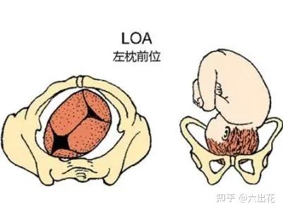 顶先露指示点是枕骨(缩写 o),臀先露指示点是骶骨(缩写s),面先露指示