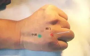 吊水,out了吧,一个液门就搞定了,艾灸,针灸,按摩都可见效 除了治感冒