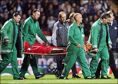 埃伍德噩梦困扰利物浦 西塞小腿骨折告别本赛季