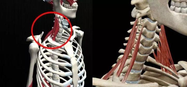 颈椎生理曲度变直怎么治疗