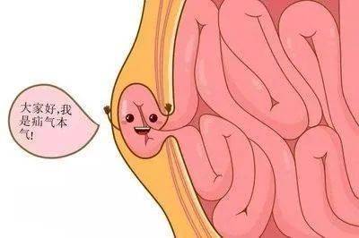 来者不疝小肠气一定需要手术吗