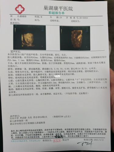 四维彩超怎样看男女呢?_四维彩超_母婴_孕产经验