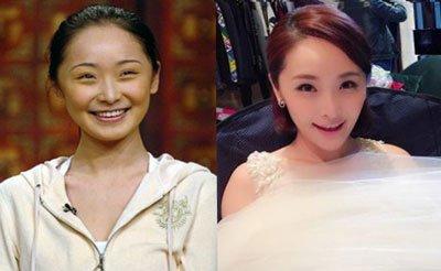 李曼铱整容前后对比 李曼铱整容失败了吗