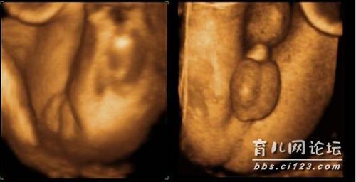    这是我在别的论坛上看到的帖子,分别是女宝和男宝的四维