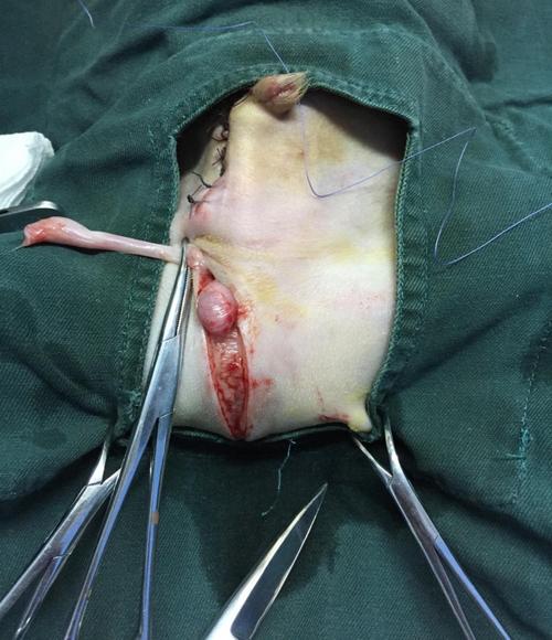 图(二) 摘除睾丸