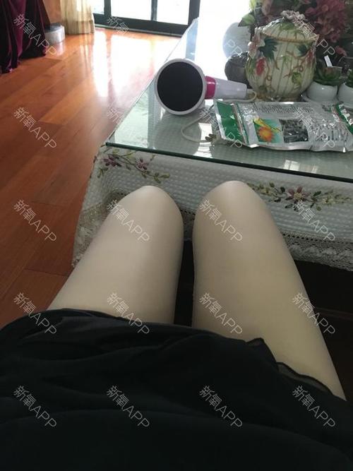 成都吸脂瘦大腿好不好_效果图_氧气_n8g7ef9f2吸脂瘦大腿术后第6天