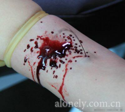 放血疗法?放的血是"疾病"还是"愚昧"?