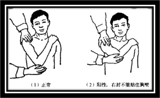 一个动作,自测是否有肩关节脱位